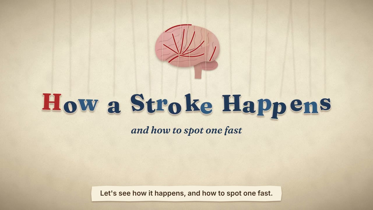 Still from the animated video How a Stroke Happens